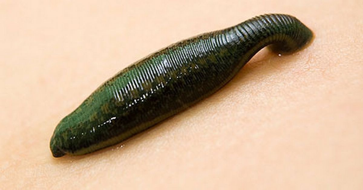 Extra-Large Medical Leech on Amazon
